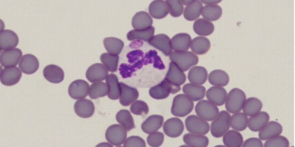 Más Allá de la Garrapata: Diagnóstico y Prevención de la Anaplasmosis Bovina, un Desafío Silencioso en el Campo