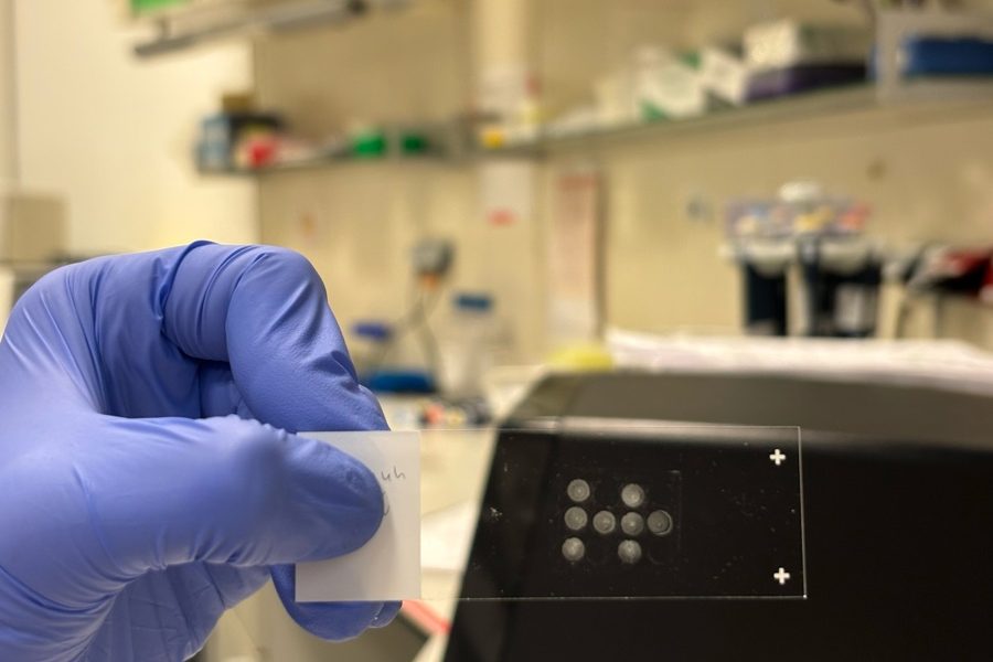 Descubren técnica para analizar millones de células a la vez