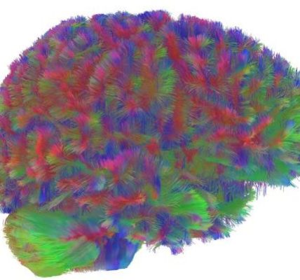 El cerebro pasa por 5 fases en la vida, que cambian a los 9, 32, 66 y 83 años