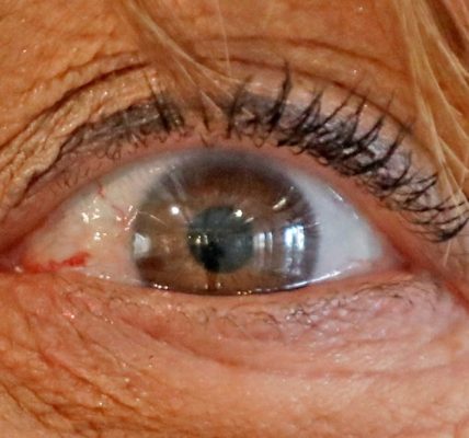 Usan IA para predecir riesgo de alzhéimer a través de las retinas