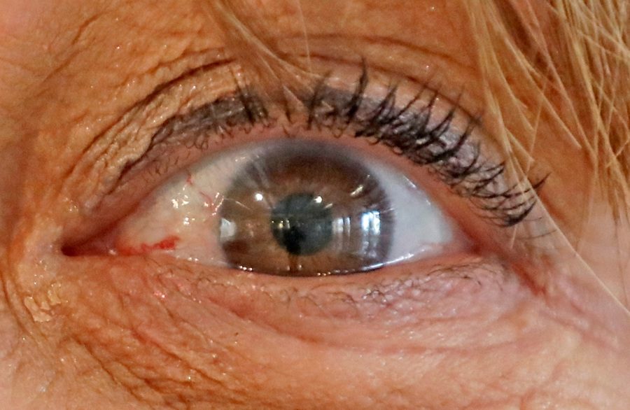 Usan IA para predecir riesgo de alzhéimer a través de las retinas